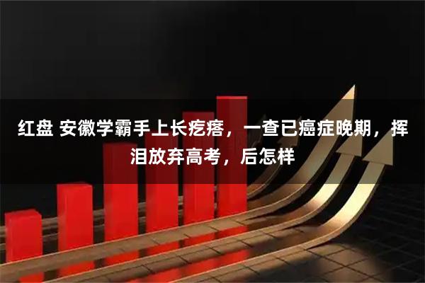 红盘 安徽学霸手上长疙瘩，一查已癌症晚期，挥泪放弃高考，后怎样